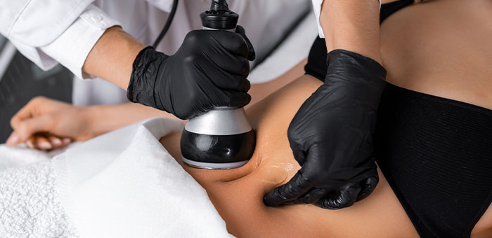 patient receiving body sculpting in Campbell