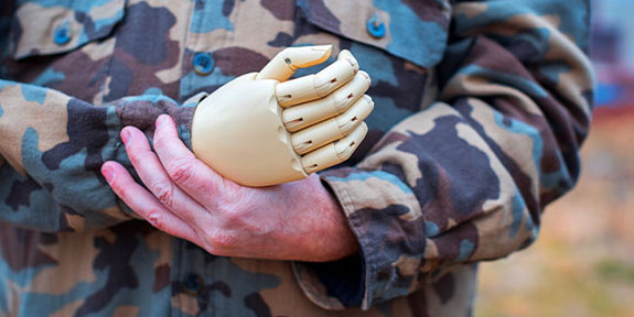 phantom limb syndrome Treatment in Campbell