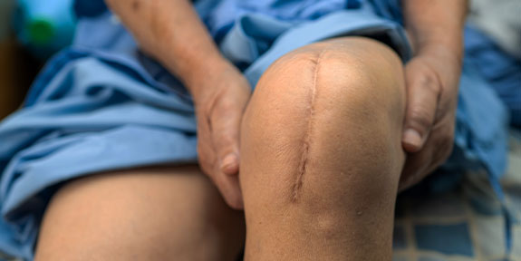 post surgical neuropathic pain Treatment in Campbell
