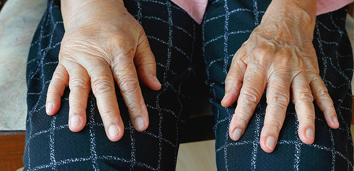 patient needing reflex sympathetic dystrophy treatment in Campbell