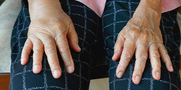 reflex sympathetic dystrophy Treatment in Campbell