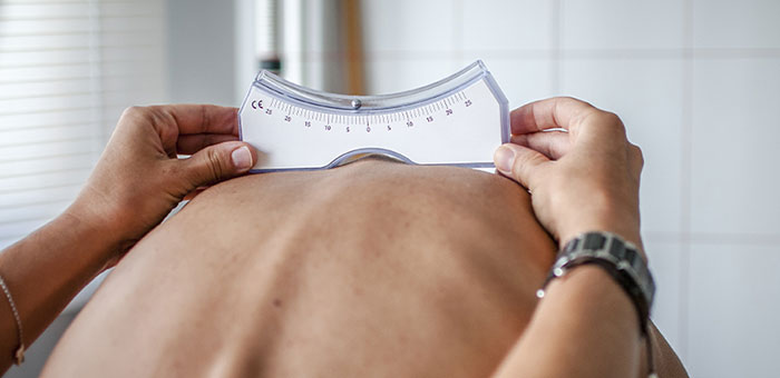 patient needing scoliosis treatment in Campbell